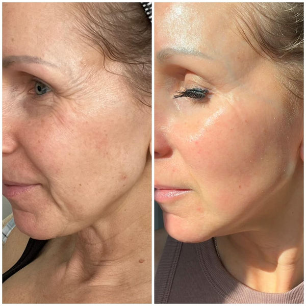Jennifer, 57